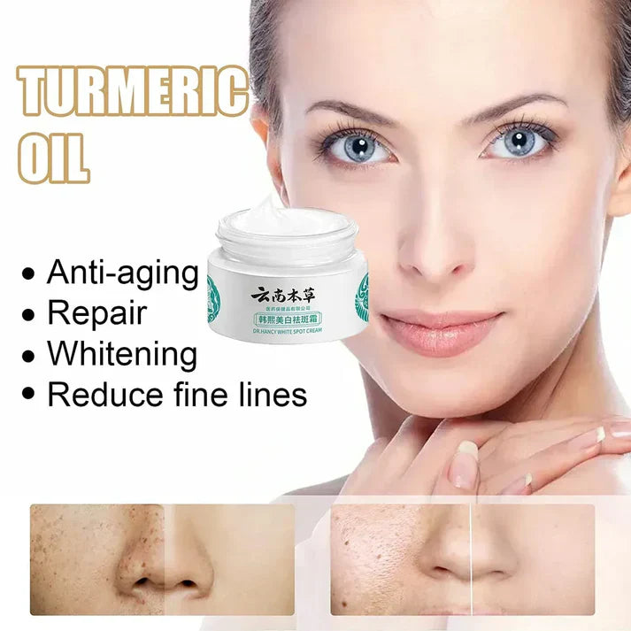 Japanese Melasma Cream